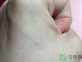 eaoron水光針多少錢(qián)幾毫升?澳洲eaoron水光針價(jià)格 eaoron水光針多少錢(qián)幾毫升?澳洲eaoron水光針價(jià)格