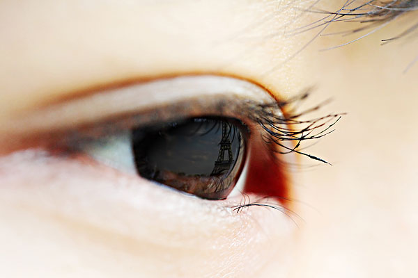 眼結(jié)石是怎么形成的？眼結(jié)石可以自己消失嗎？