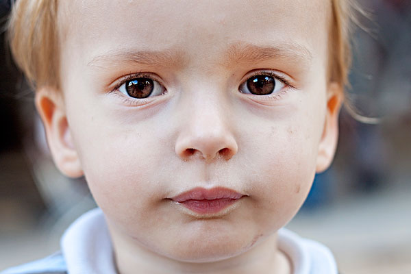 眼結(jié)石是怎么形成的？眼結(jié)石可以自己消失嗎？