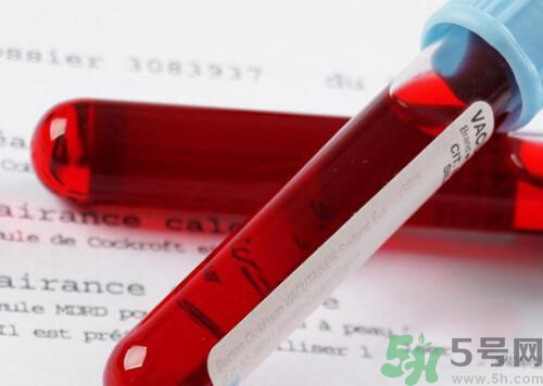 獻(xiàn)血后可以洗澡嗎？抽血后可以洗澡嗎？