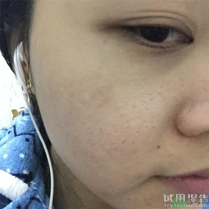 菲洛嘉十全大補面膜怎么用 菲洛嘉十全大補面膜使用方法 菲洛嘉十全大補面膜怎么用 菲洛嘉十全大補面膜使用方法