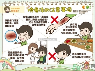 手被油燙傷了怎么處理？手被油燙起泡了怎么辦？