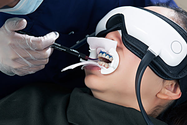 嚴(yán)重口腔潰瘍怎么快速好的快？嚴(yán)重口腔潰瘍能抽煙嗎？