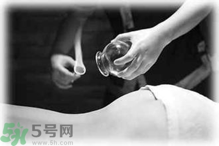 大暑可以拔罐嗎？大暑拔罐好不好？