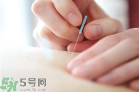 大暑可以針灸嗎？大暑針灸好不好？