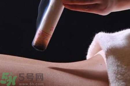 大暑可以艾灸嗎？大暑艾灸的好處有哪些？