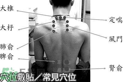 經(jīng)期可以貼三伏貼嗎？來月經(jīng)可以貼三伏貼嗎？