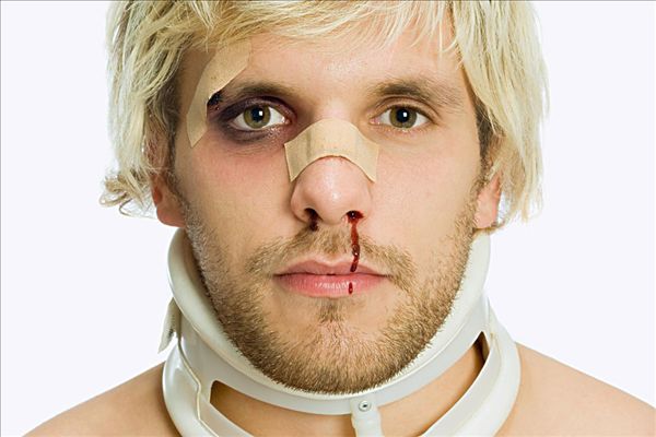 天氣太熱會流鼻血嗎？天氣太熱流鼻血是什么原因？