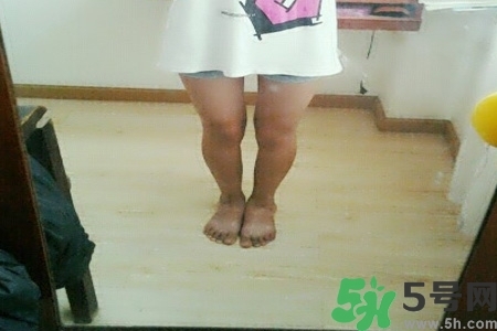 腿曬黑了怎么白回來？腿曬黑了怎么辦？