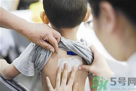 肝炎貼三伏貼有用嗎？肝病貼三伏貼貼哪里？