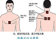 腰痛貼三伏貼有用嗎？腰痛三伏貼貼哪個(gè)穴位？