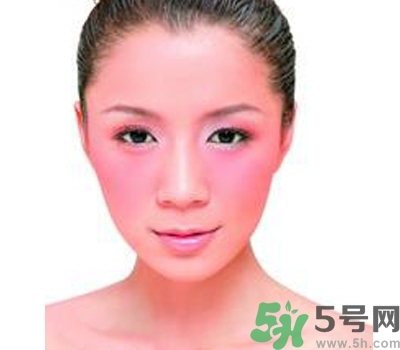 敏感性皮膚用什么洗面奶？敏感性皮膚怎么修復(fù)？