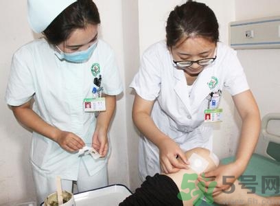 三伏貼可以自己貼嗎？三伏貼貼要找穴位嗎？