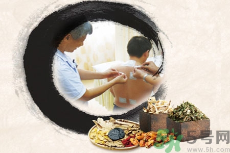 三伏貼可以自己貼嗎？三伏貼貼要找穴位嗎？