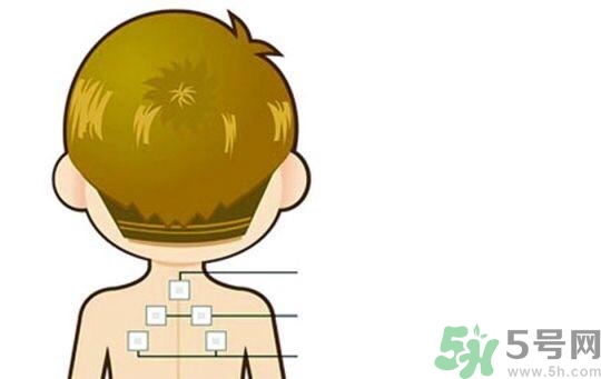 三伏貼可以去濕氣嗎？三伏貼去濕氣貼哪里？