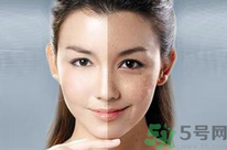 干性皮膚用什么洗面奶？干性皮膚該怎么保養(yǎng)？