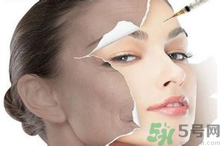 美白針效果怎么樣？美白針有副作用嗎？