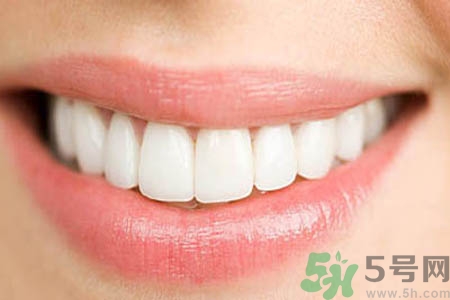 洗牙的好處有哪些？洗牙的好處是什么？