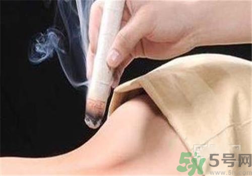 蕁麻疹可以艾灸嗎？蕁麻疹艾灸哪個穴位？