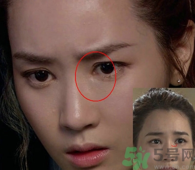 開眼角多少錢？開眼角有什么危害？