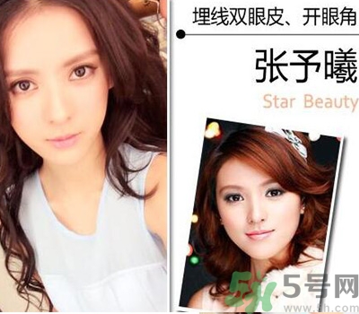 開眼角眼睛會(huì)變大嗎？開眼角眼睛能大多少？