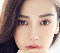 開眼角會留疤嗎？開眼角增生怎么辦？