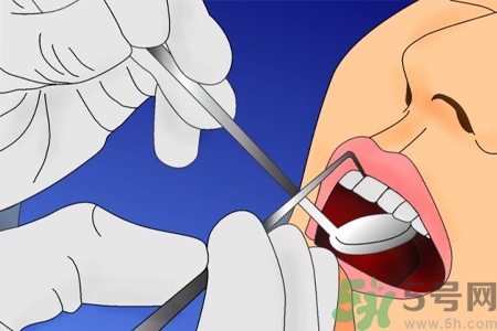 拔牙后需要注意什么？拔牙前需要注意什么？