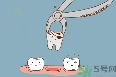 拔牙后需要注意什么？拔牙前需要注意什么？