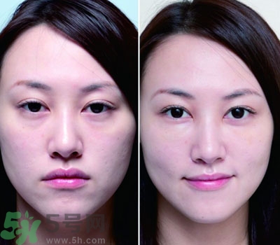 臥蠶是什么？臥蠶是眼袋嗎？