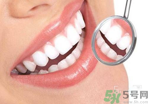 洗牙后多久可以刷牙？洗牙后怎么刷牙？