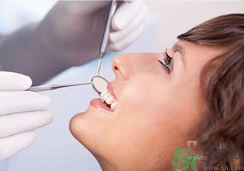 洗牙后多久可以刷牙？洗牙后怎么刷牙？