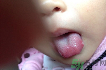 舌頭長泡怎么辦？舌頭長泡的原因？