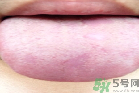 舌頭發(fā)白是什么原因？舌苔發(fā)白是怎么辦？