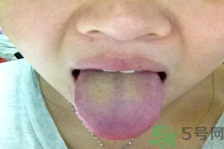 舌苔厚黃是怎么回事？舌頭發(fā)黃怎么辦？