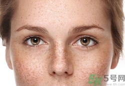 曬太陽會(huì)長(zhǎng)斑嗎?曬太陽長(zhǎng)斑怎么辦