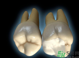 牙齒根管治療多少錢？根管治療一顆要多少錢？