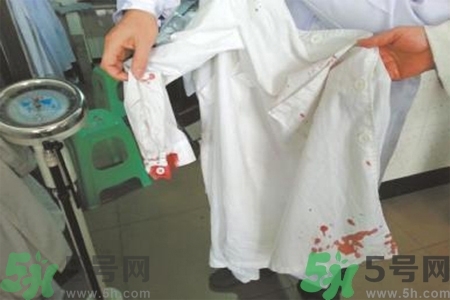 清除衣服上血跡的方法有什么？