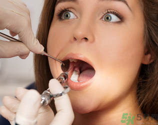 根管治療有什么危害？根管治療的適應癥有哪些？