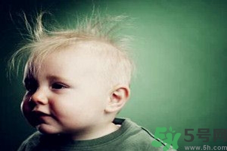 寶寶頭發(fā)少怎么辦？寶寶頭發(fā)少什么原因？