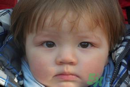 寶寶頭發(fā)黃怎么辦？寶寶頭發(fā)黃什么原因？