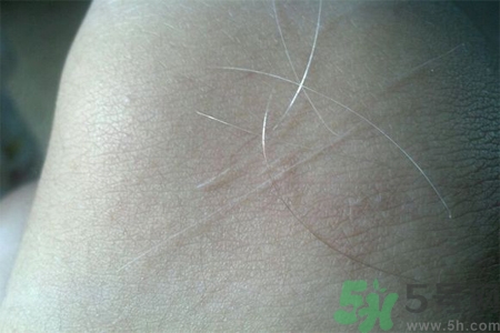 生完寶寶白頭發(fā)的原因？生完寶寶白頭發(fā)怎么辦？