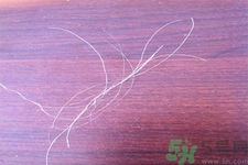 生完寶寶白頭發(fā)的原因？生完寶寶白頭發(fā)怎么辦？