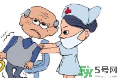 癲癇的典型癥狀有哪些？癲癇是什么？