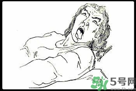 癲癇的護理措施？癲癇的飲食護理是什么？