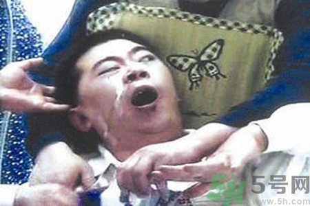 癲癇的發(fā)病因素？癲癇的并發(fā)癥有哪些？