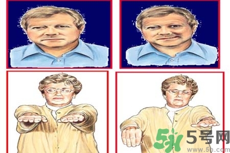 腦中風(fēng)的治療方法？腦中風(fēng)的藥物治療？