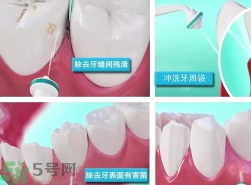 水牙線是什么?水牙線有什么作用 水牙線是什么?水牙線有什么作用