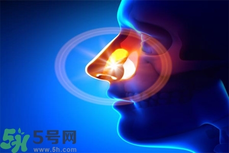 鼻竇炎的高發(fā)人群？如何預(yù)防鼻竇炎？