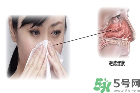 過敏性鼻炎的高發(fā)人群有哪些？如何預(yù)防過敏性鼻炎？