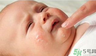 寶寶長奶蘚怎么回事？寶寶長奶蘚怎么辦？